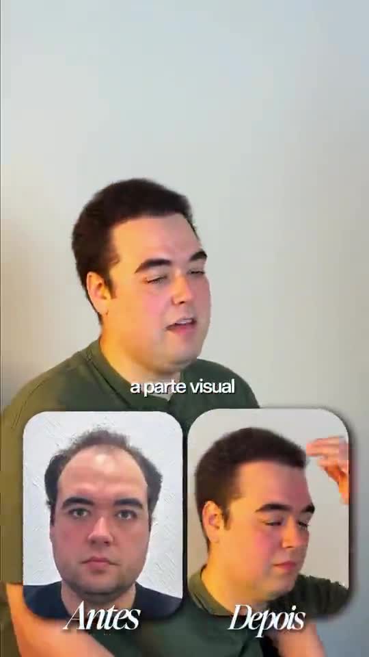 Paciente do Instituto mostrando o antes e depois do transplante